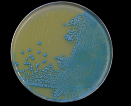 Biological Hazards