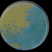 Biological Hazards